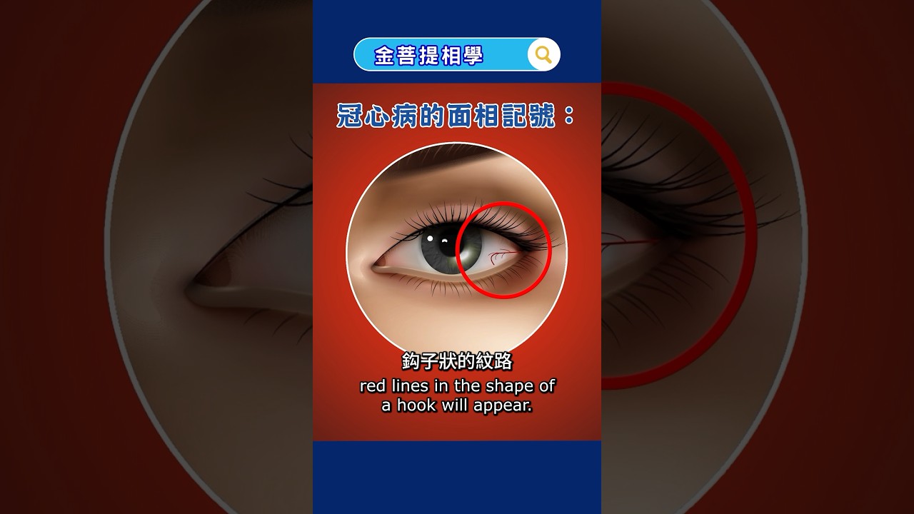 This red line in the eye can be an indication of coronary heart disease.#JinBodhiPhysiognomy #health